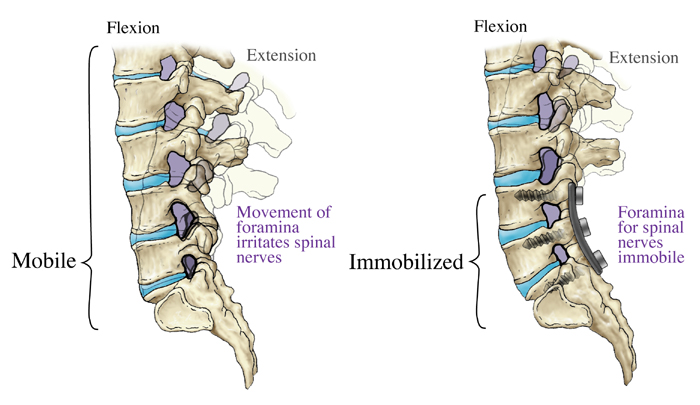 Spine Flexion