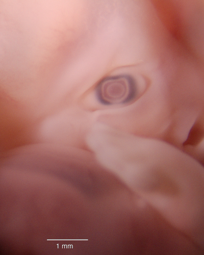 44 Day Human Embryo