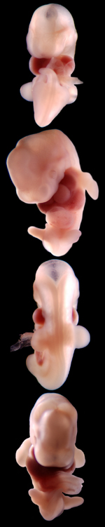 32 Day Human Embryo