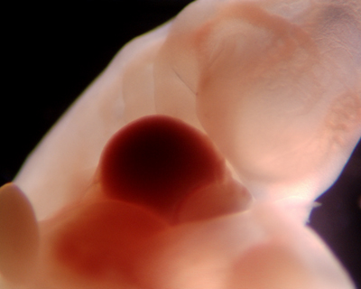 32 Day Human Embryo