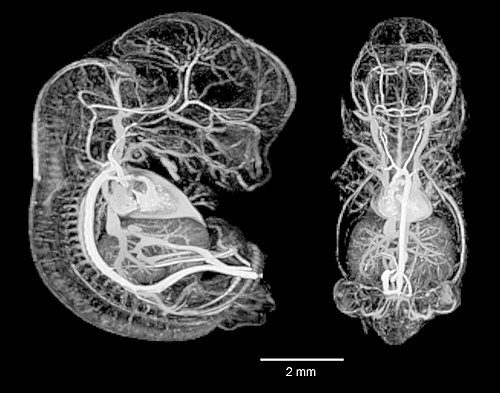 12.5 Day Mouse Embryo Vasculature