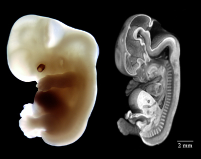 50 Day Human Embryo