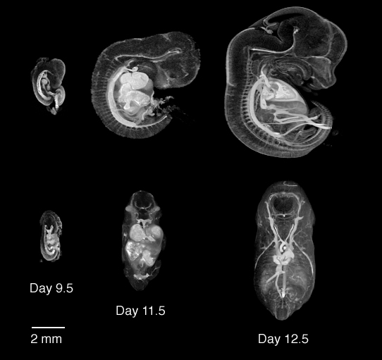 MRIs of mouse embryo vasculature