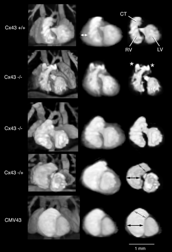 MRIs of Normal and Altered Mouse Embryo Hearts