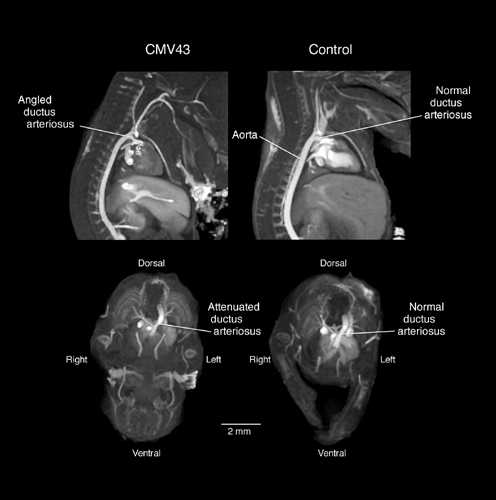 MRIs of Normal and Altered Mouse Embryo Heart Development
