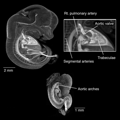 MRI of Mouse Embryo Heart and Aortic Arches