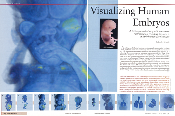 Scientif American journal spread showing human embryo MRI imaging