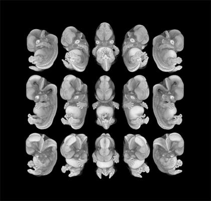 MRI views of a 50-day human embryo