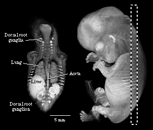 MRI cut-away view of a 56-day embryo
