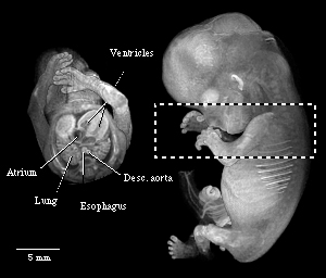 Cut-away view of a 56-day embryo