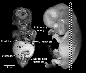 Cutaway view of a 56-day human embryo