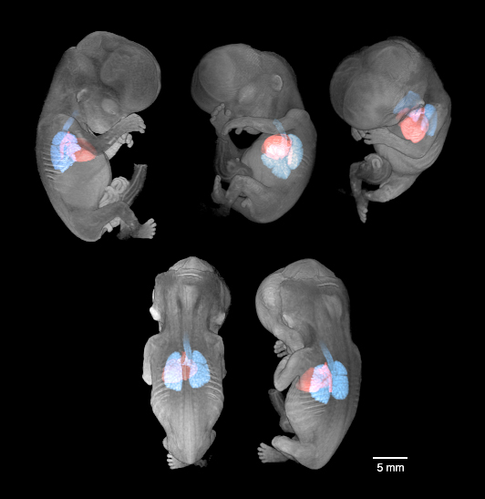 MRI image of lungs and heart in a 56-day embryo.
