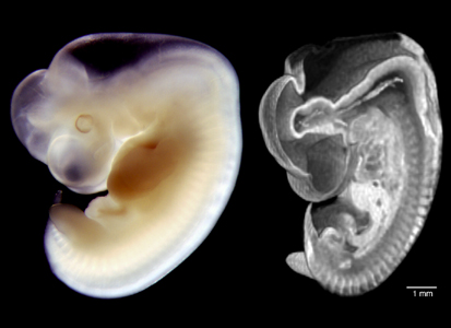 Optical image and MRI image comparison in a 37-day human embryo.
