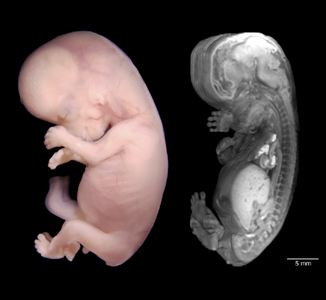 Optical and MRI image comparison of a 56-day human embryo.