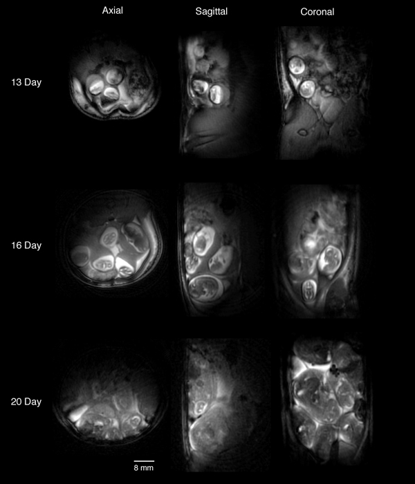 In-Utero MRI Imaging of Rat Embryos