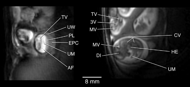 In-Utero MRI Imaging of Rat Embryos