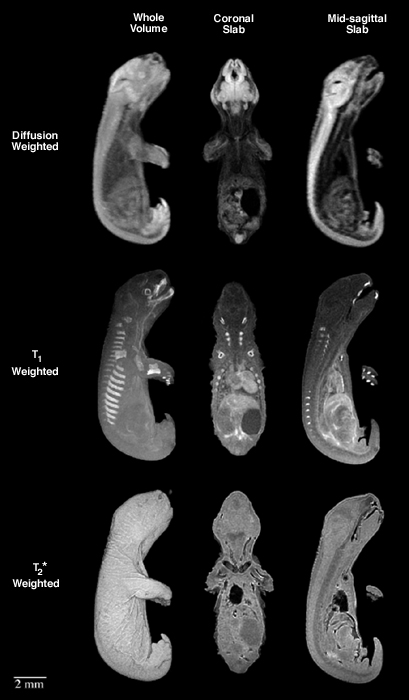 MRI images of opossum fetus