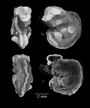 MRI of malformed mouse embryo