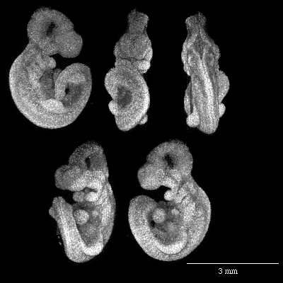 MRI of a mouse embryo