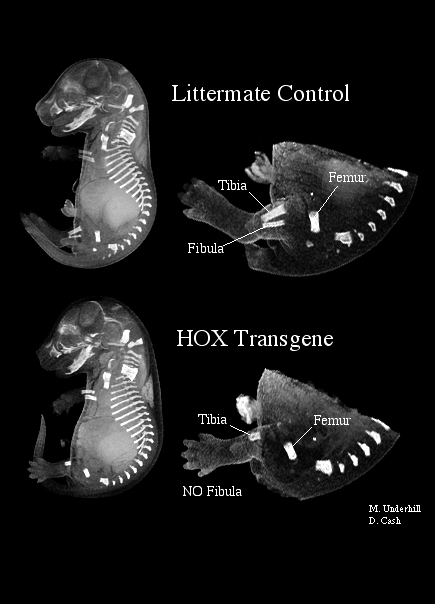 MRI showing bone development in mouse embryo with HOX transgene